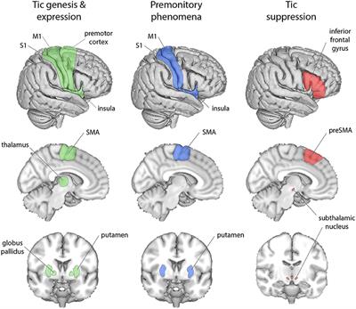 A Bayesian Account of the Sensory-Motor Interactions Underlying Symptoms of Tourette Syndrome